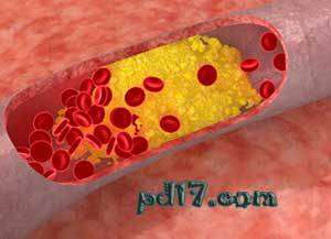 基因突变造成的罕见能力盘点：无法吸收胆固醇